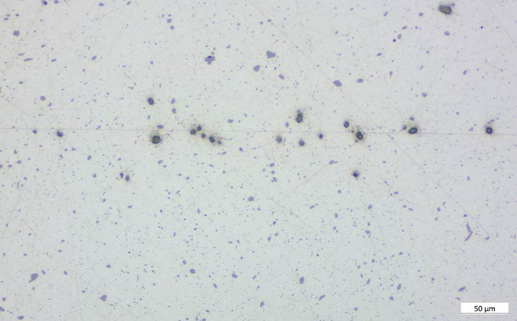 Figure 4: Embedded abrasives (black spots) in free cutting steel.